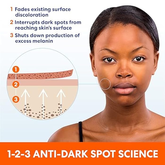 Palmer's Skin Success Anti-Dark Spot Fade Cream with Vitamin E and Niacinamide, for All Skin Types 2.7 Ounce - Image 5